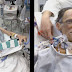  First human head transplant has been carried out on a corpse successfully in China,