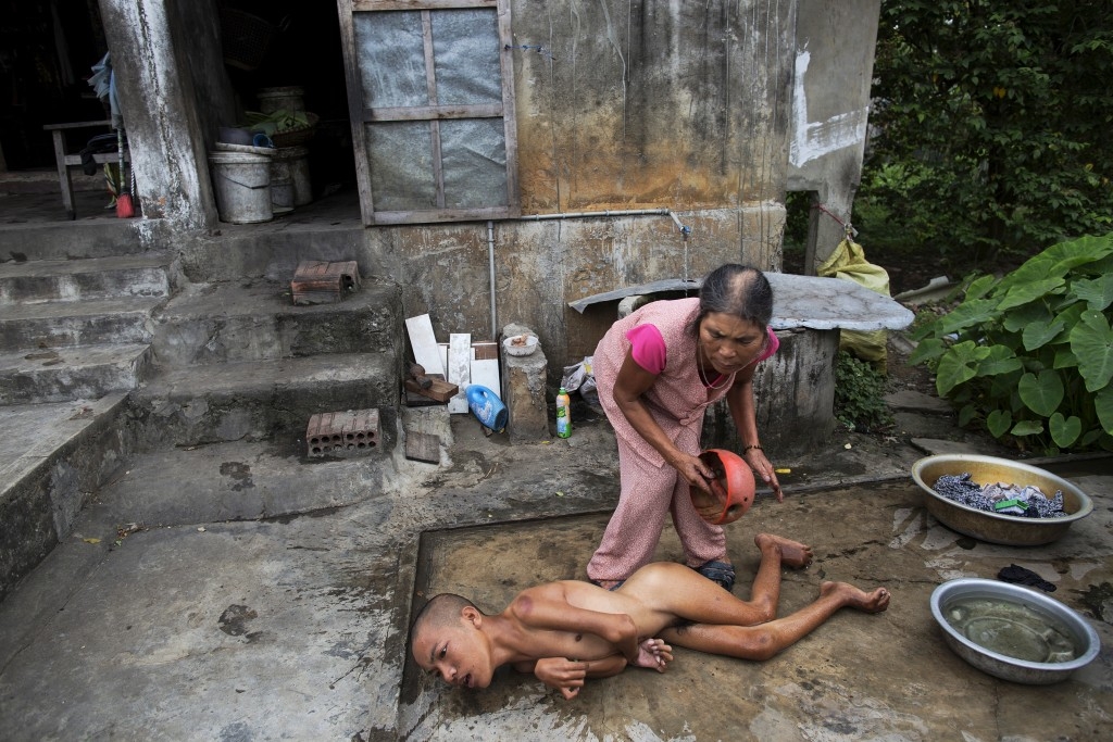 70 Of The Most Touching Photos Taken In 2015 - Tang Thi Thang bathes her disabled son outside their home in Truc Ly, Vietnam. His father was exposed to Agent Orange during the Vietnam war.