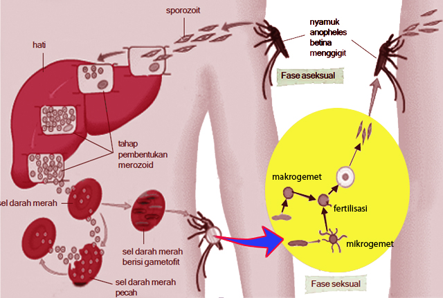 Gejala Penyakit Malaria