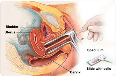 PEMERIKSAAN PAP SMEAR PDF PEMERIKSAAN PAP SMEAR PDF