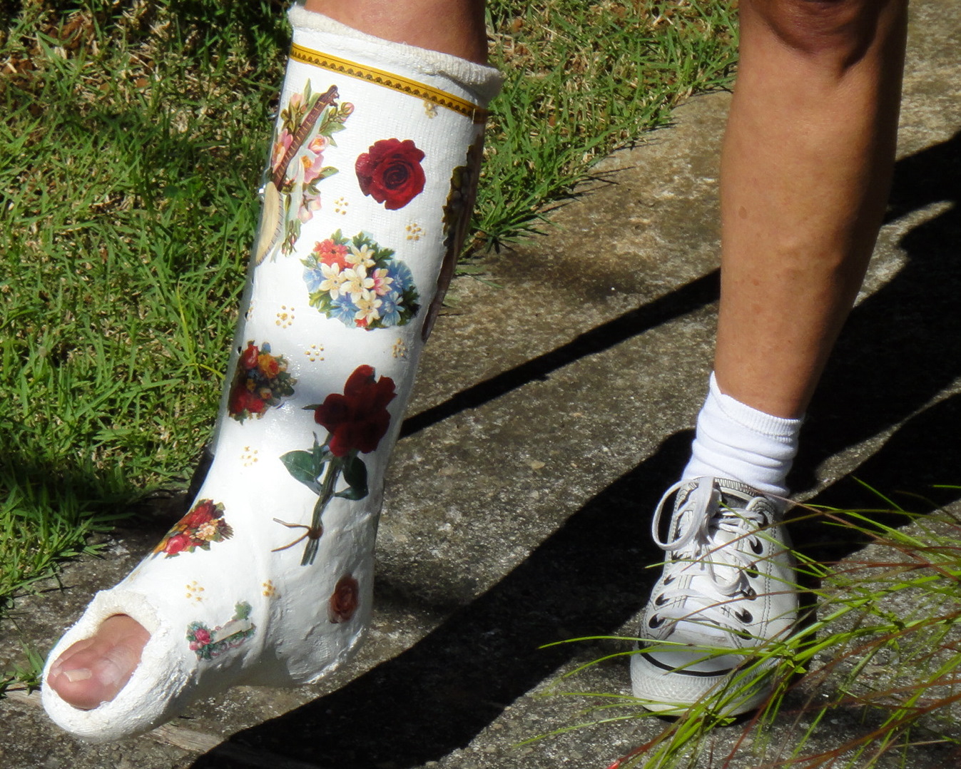 Plaster Cast Blog da Virginia Costa