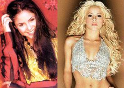 Shakira+Antes+y+Despues.jpg