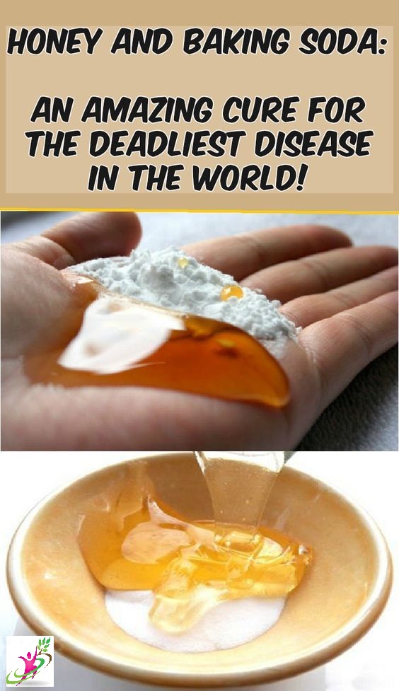 Honey and Baking Soda An Amazing Cure For The Deadliest Disease in the