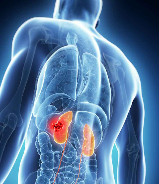 5 Bad habits that damage your kidney
