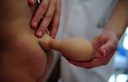 baby born with tail in china