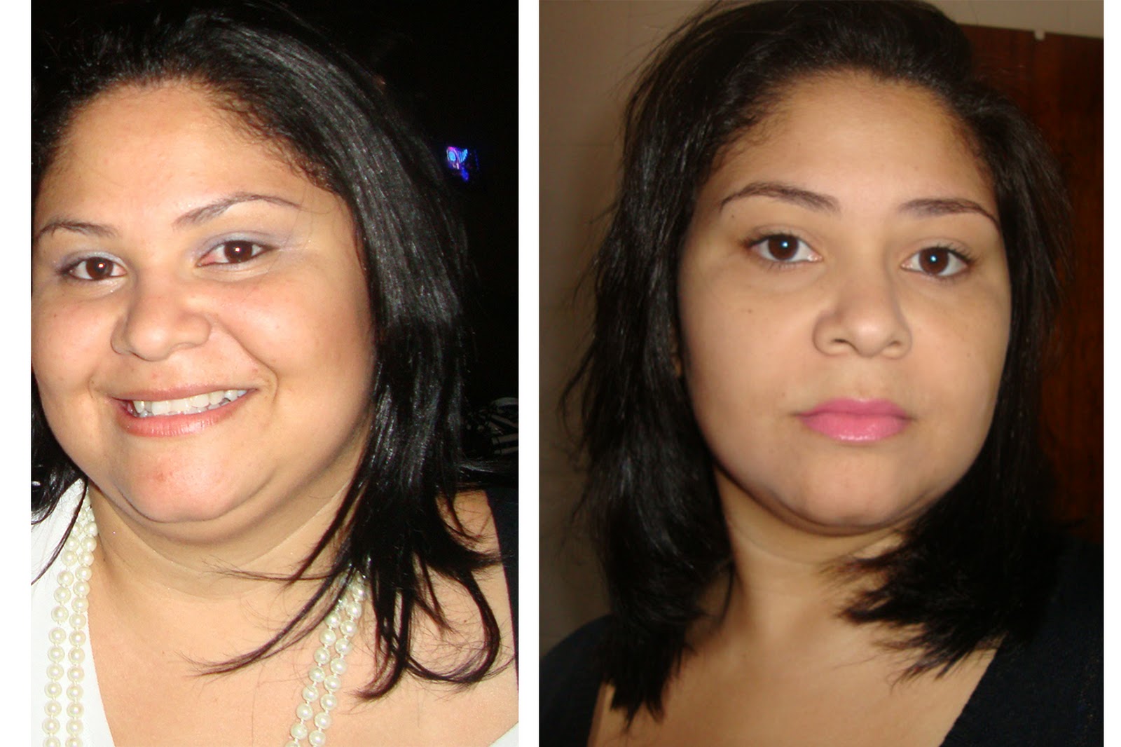 Fazendo as pazes com a balança SLEEVE GÁSTRICO Meu primeiro