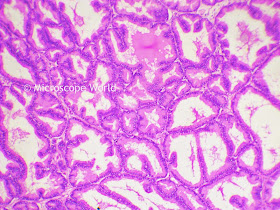 Prostate gland under microscope at 100x.