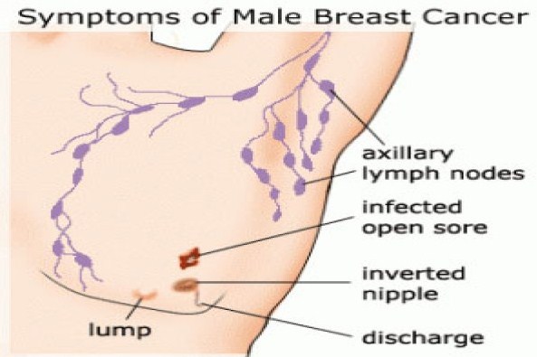 sore male breast Haveing sex with poop