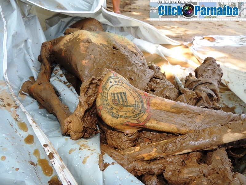 Encontrado Em Vários órgãos Ocos Do Corpo
