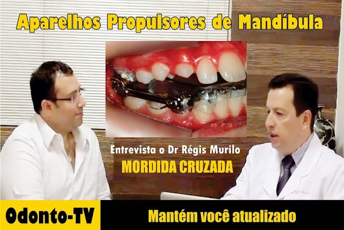MORDIDA CRUZADA: Uso de Aparelhos Propulsores de Mandíbula - Entrevista o Dr Régis Murilo