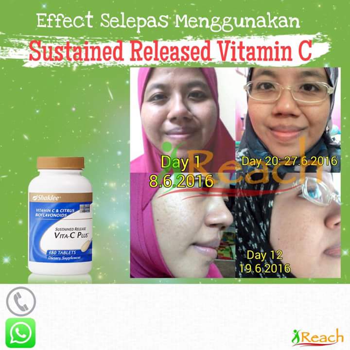 VITAMIN C UNTUK KULIT PUTIH GEBU YANG SELAMAT DAN BERKESAN Cantik