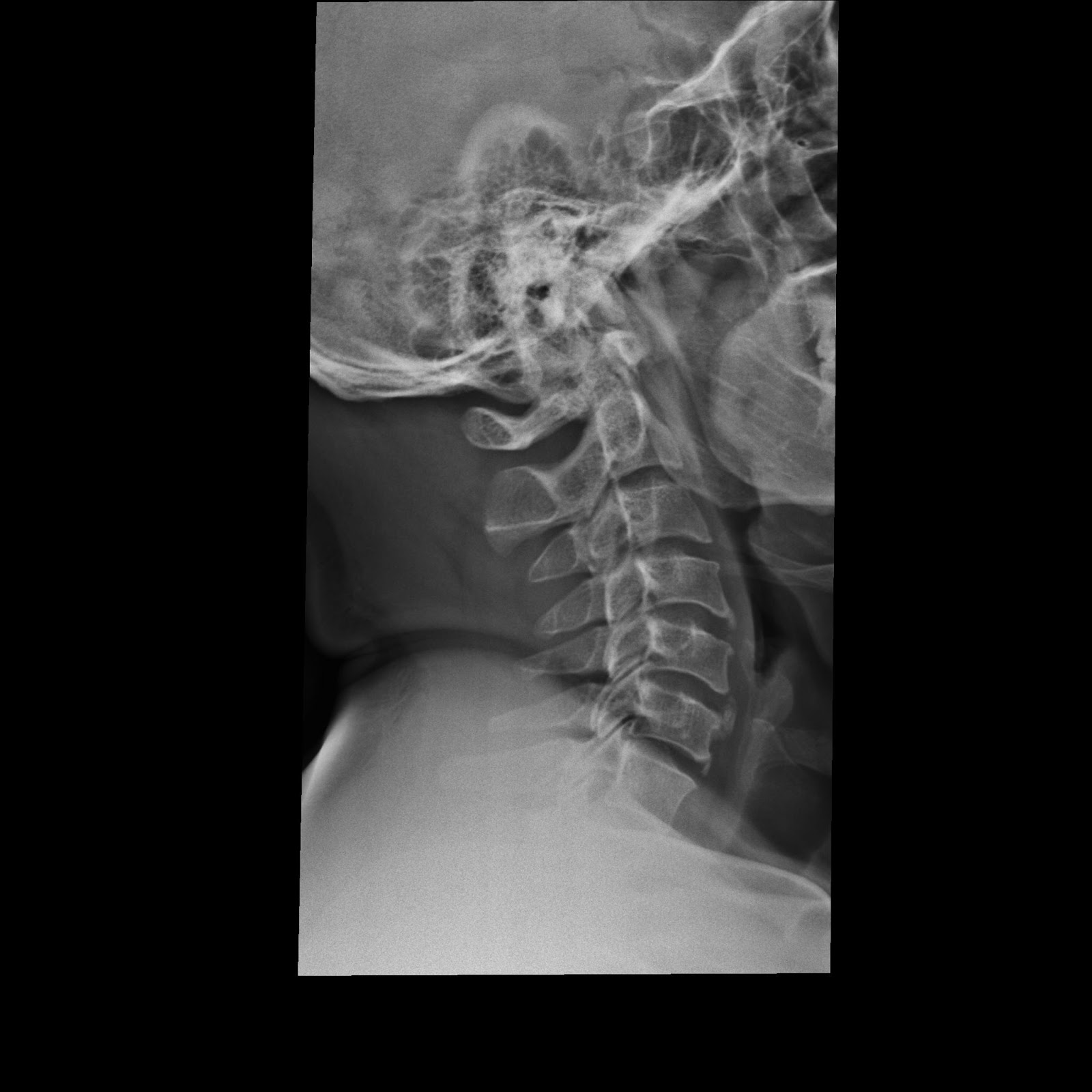 SPINE: Fixed in Abuja: August 2013