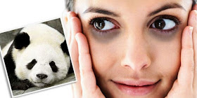 Mata-panda-hilang-dengan-eye-treatment-youth