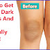 How to Get Rid Of Dark Knees and Hands with Suger and Olive Oil In 7 Days