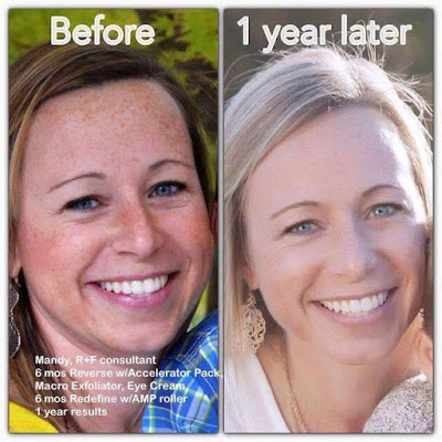 Rodan + Fields Reverse Regimen Results, Reverse Before and After, Anti-Aging Skin Care, Julie Little