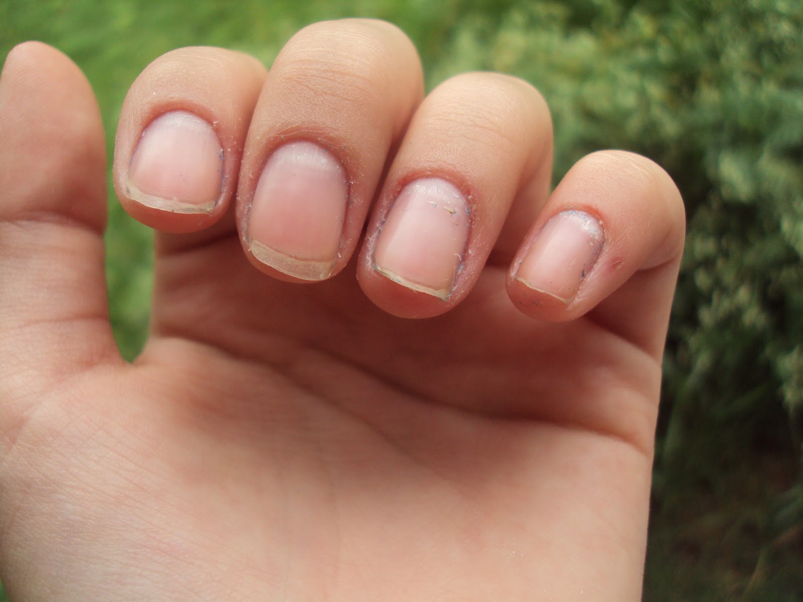 Dedos Mágicos Problem Cuticle Remover Sally Hansen