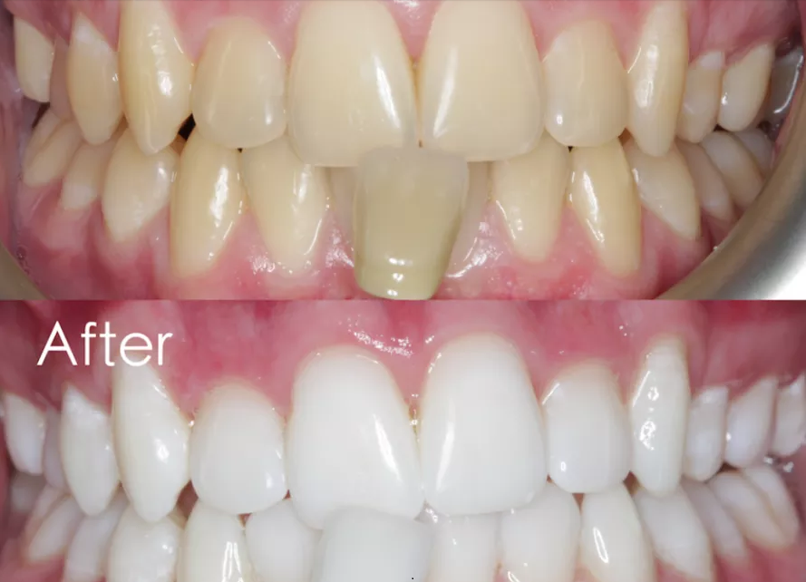 Benefit Of Turmeric For Oral Health HEALTH GUIDE 911