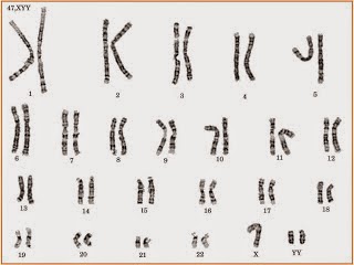 Anti-Remed with MECO MMSA: Skenario 2 Part 2 Block 7