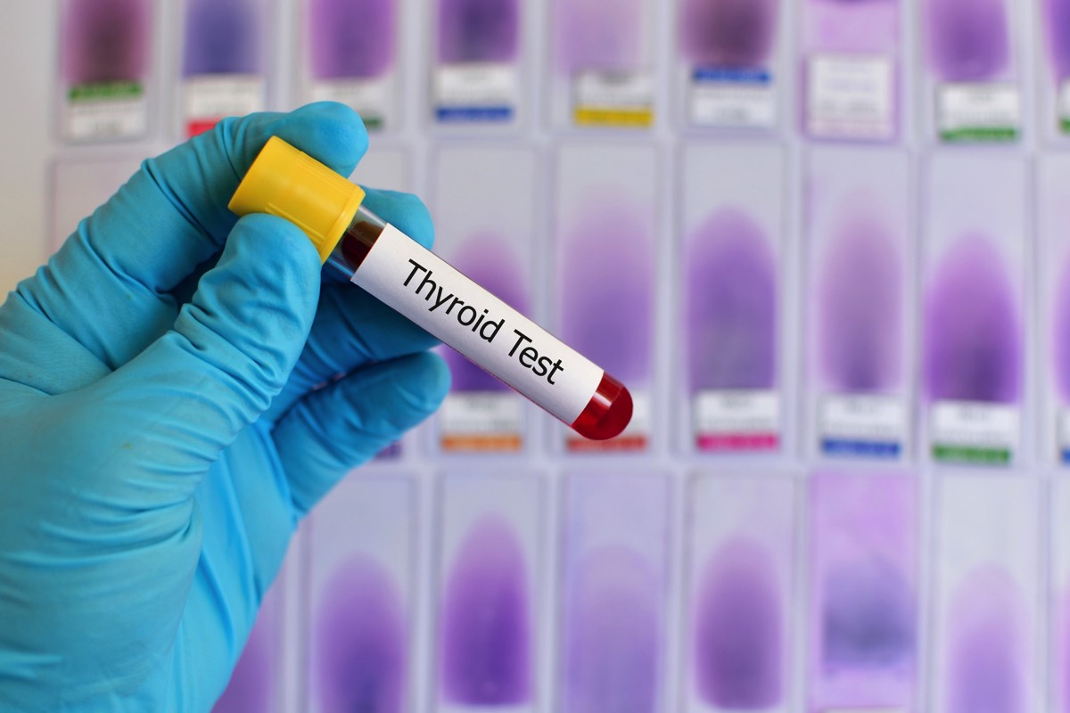 Thyroid test and thyroid cancer diagnosis. what are the symptoms of