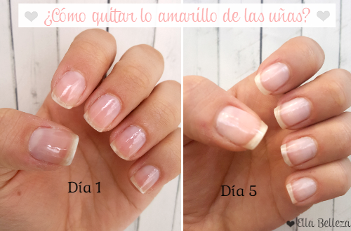 ¿Cómo quitar lo amarillo de las uñas?