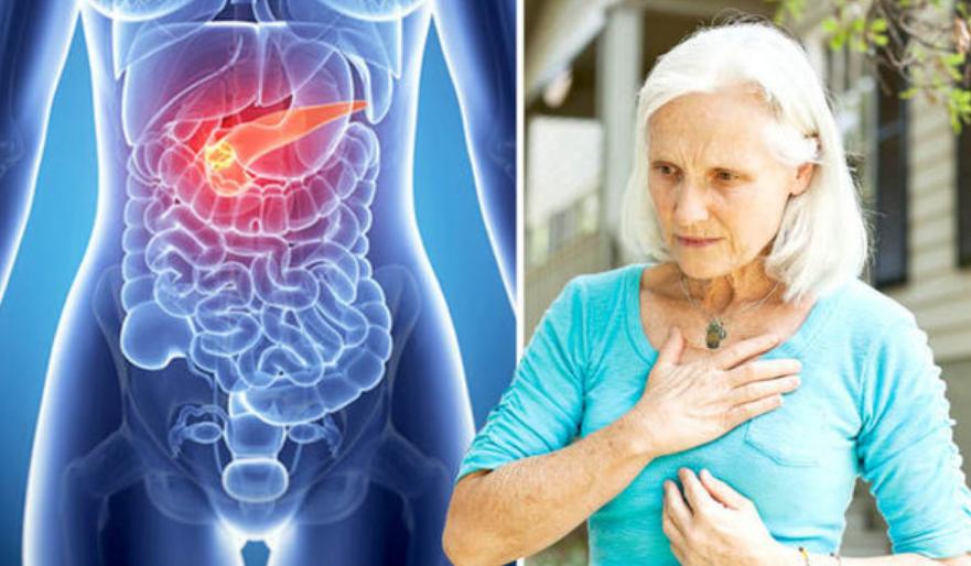 What Are The Symptoms Of Pancreatic Cancer In A Woman