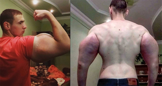 Russo injeta óleo nos bíceps para ter braços do Popeye - Img 3