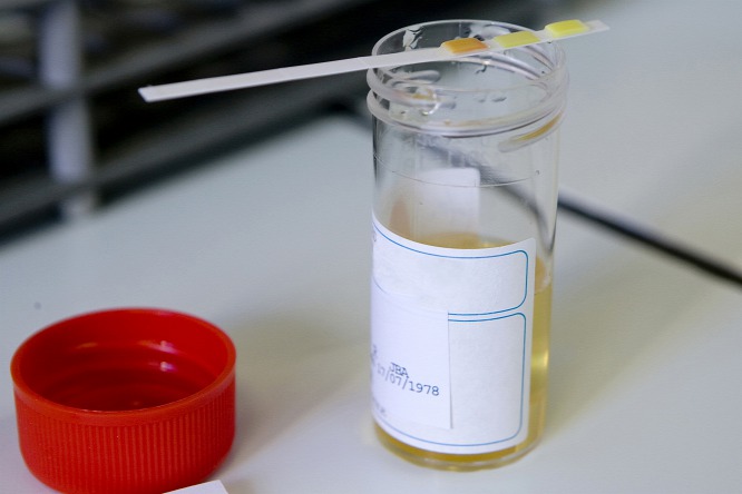 do they drug test your urine at prenatal visits do they drug test your urine at prenatal visits