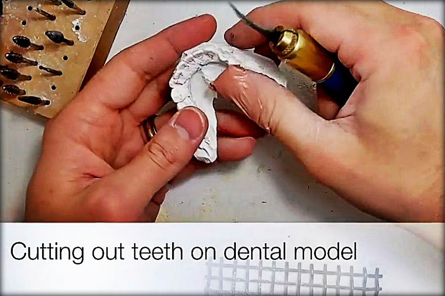 LABORATORY Cutting teeth out ona dental model (another method)