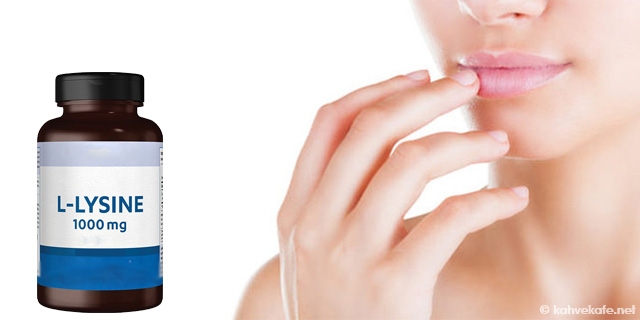 ucuk nasil gecer ucuga en hizli cozum evde ucuga ne iyi gelir kahvekafe kahve dunyasindan bilgiler ve tarifler