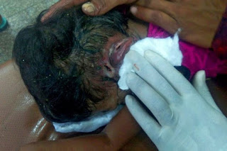 Ngeri! Rasa Gatal di Telinga Sering Disepelekan, Ternyata Hewan Mengerikan Ini Bersarang di Dalamnya! Ngeri! Rasa Gatal di Telinga Sering Disepelekan, Ternyata Hewan Mengerikan Ini Bersarang di Dalamnya!