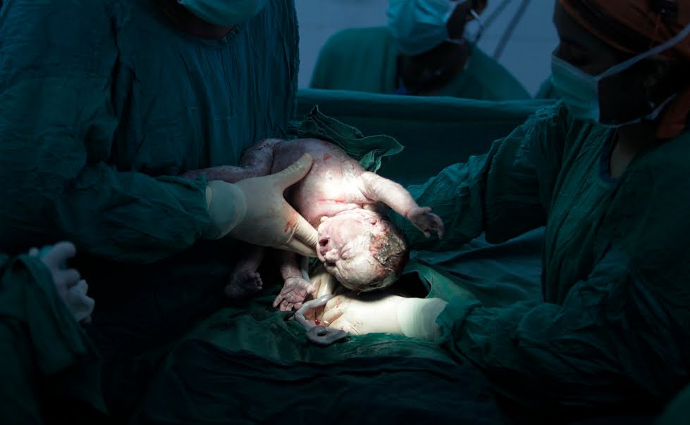 Incredibile! Partorisce con taglio cesareo senza anestesia.
