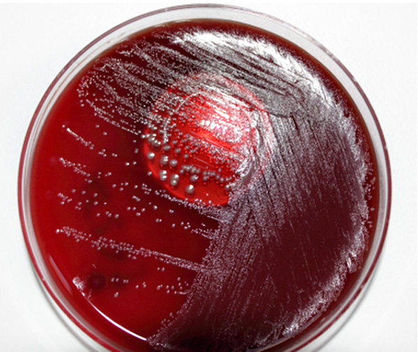 La biología mola AGARAGAR La biología mola AGARAGAR