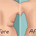 Eliminate Back Fat And Underarm Flab With 4 Quick Exercises