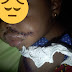 Man Left In Shock After His Niece Returned Home From School With Deep Cuts All Over Her Body (Photos)