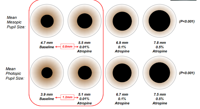 one pupil bigger than the other one pupil bigger than the other