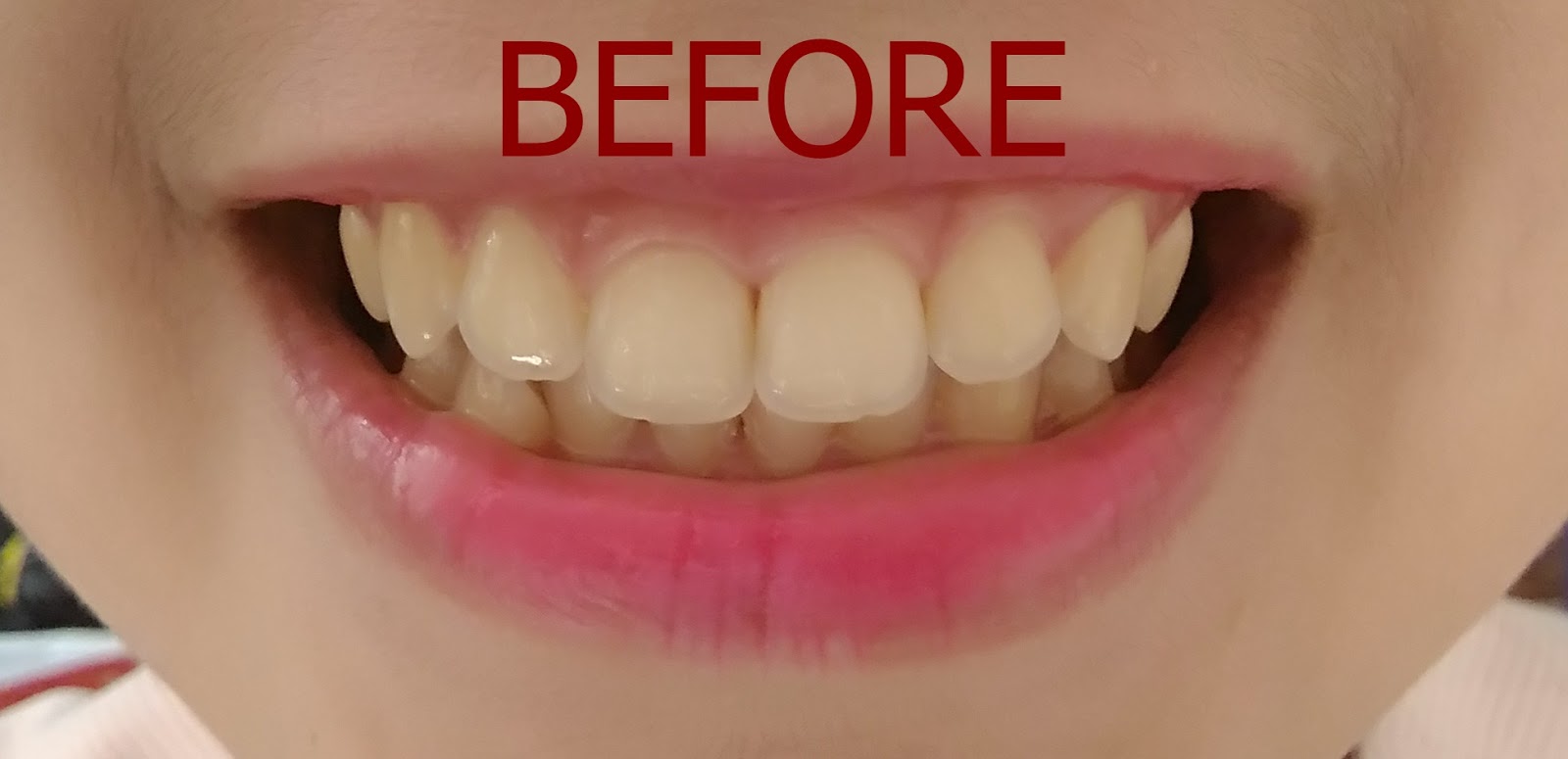 CREST WHITENING STRIPS AN HONEST REVIEW MRS. A