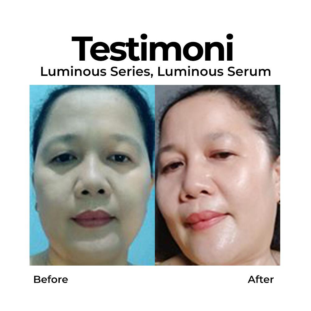 testimoni ms glow skin care