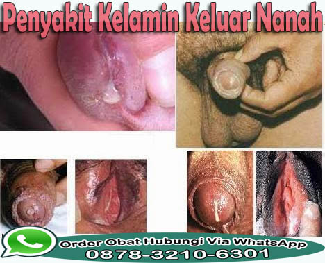 Obat Kencing Sakit Dan Tidak Lancar Obat Kencing Sakit Dan Tidak Lancar
