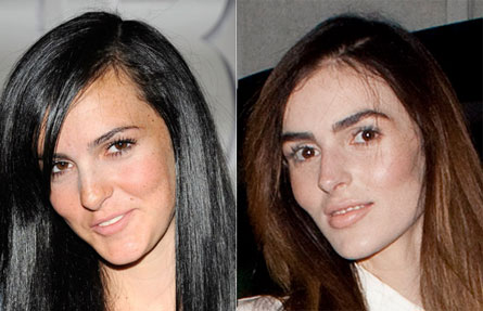 Ali Lohan’s change in facial structure is due to a 'growth spurt' not ...