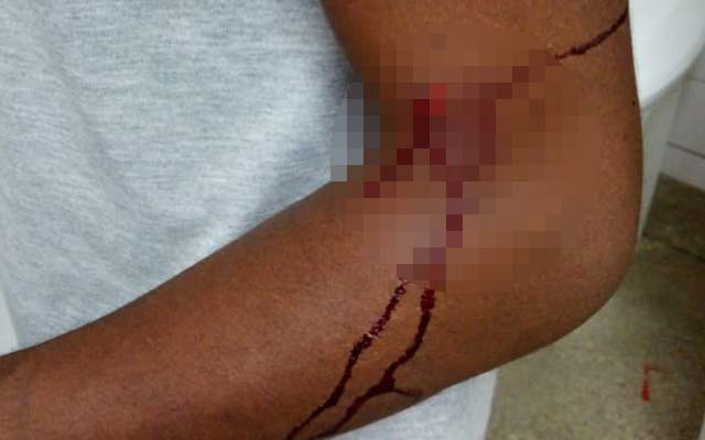 Aluno é esfaqueado por colega durante discussão próximo a colégio de Serrolândia