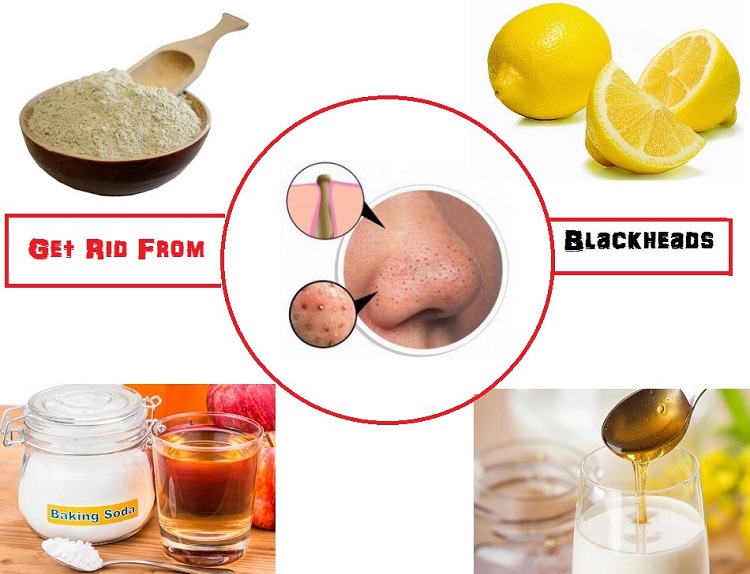 Easy and Quick Home Remedies for Blackhead on Nose Beauty Tips