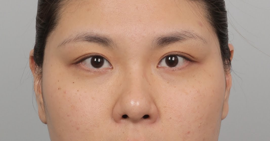 ID Hospital Korea [ID Hospital Korea Experiences] Anyone can have a