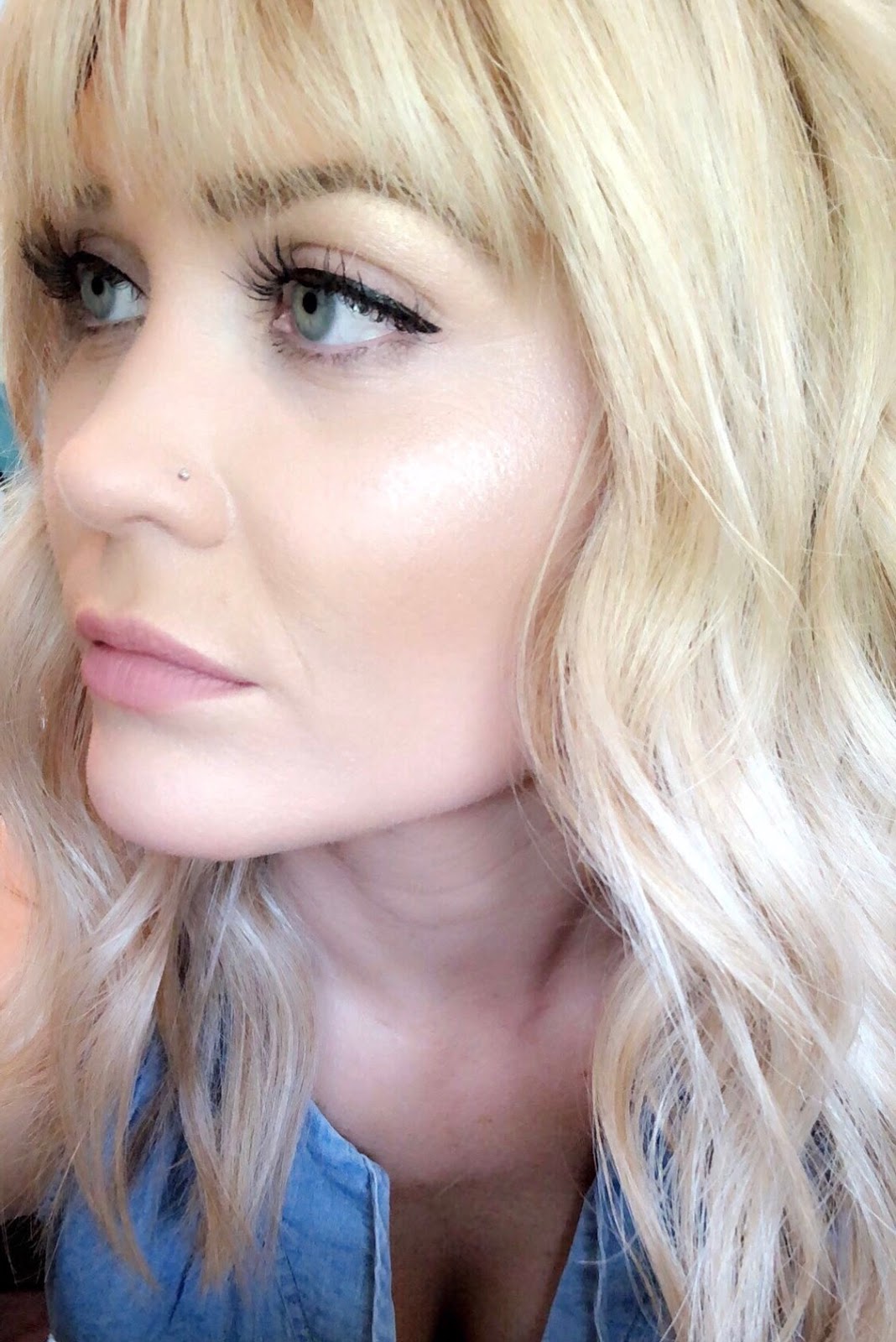 The Surface Of My Skin Is Still Smooth After Both Imiquimod And Fluorouracil The Only Lasting Effects Seem To Be Discoloration Loss Of Pigmentation And The Surface Of My Skin Is Still Smooth After Both Imiquimod And Fluorouracil The Only Lasting Effects Seem To Be Discoloration Loss Of Pigmentation And