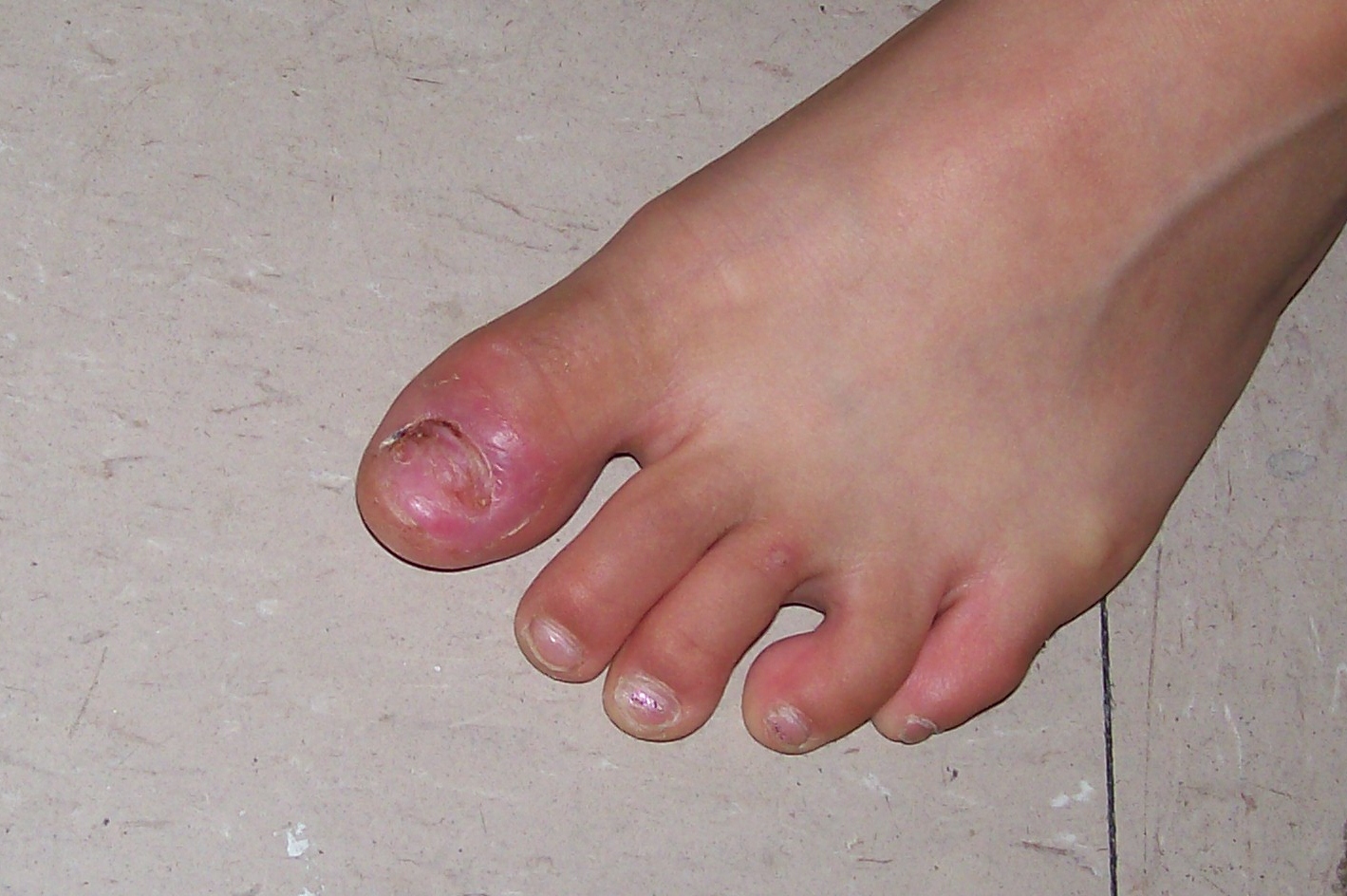 now what do i say? general conference and afton's toe.