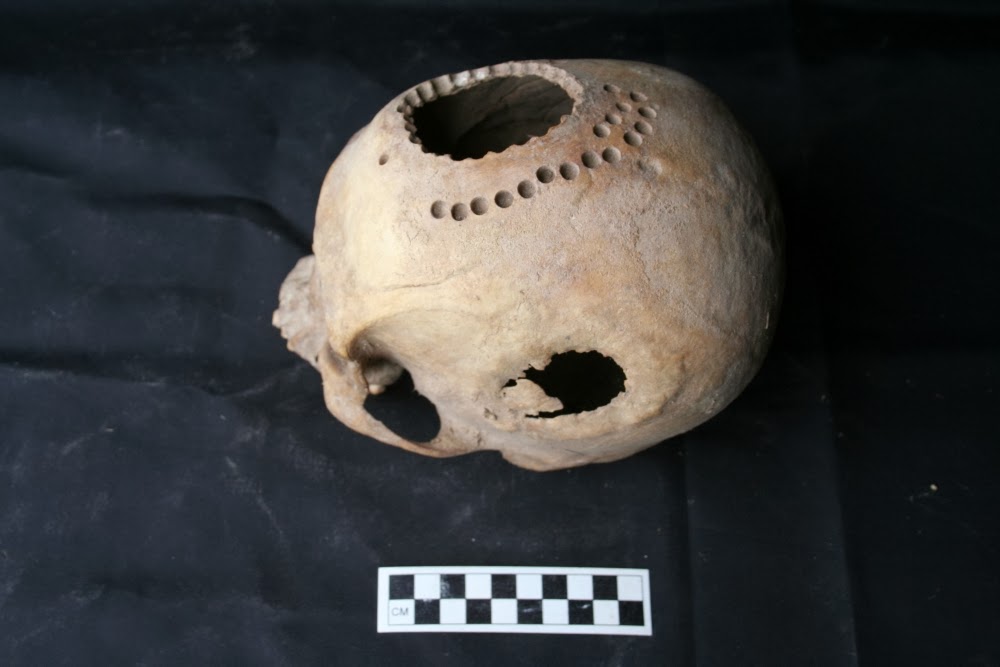 Ancient cranial surgery in Peru investigated