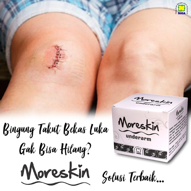 testimoni moreskin underarm nasa testimoni moreskin underarm nasa