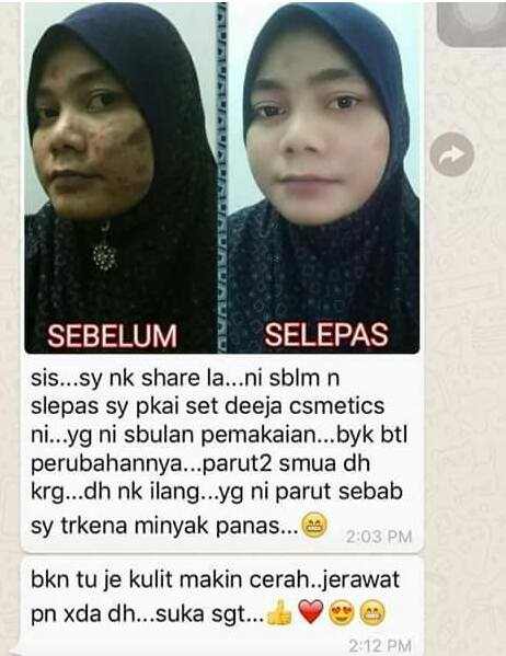 Nak Cantik Cari Saya Deeja Cosmetic 5in1 Diamond Foundation