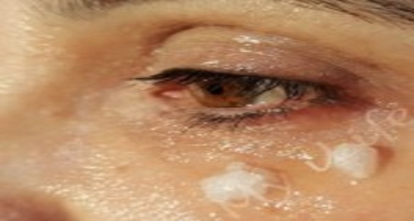 ELLA COMENZÓ A APLICAR ACEITE DE COCO ALREDEDOR DE SUS OJOS. 5 MINUTOS MÁS TARDE ... INCREÍBLE! ELLA COMENZÓ A APLICAR ACEITE DE COCO ALREDEDOR DE SUS OJOS. 5 MINUTOS MÁS TARDE ... INCREÍBLE!