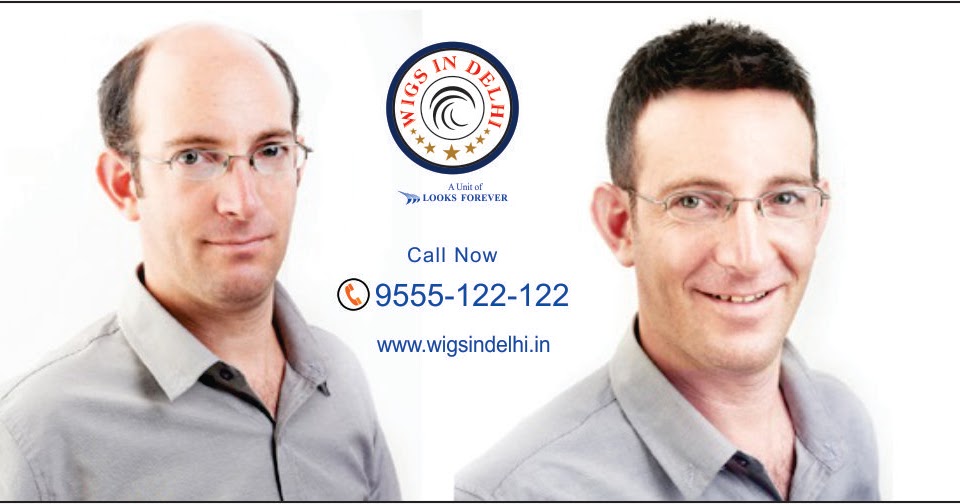 Does Medications leads to Hair Loss? - Wigs in Delhi