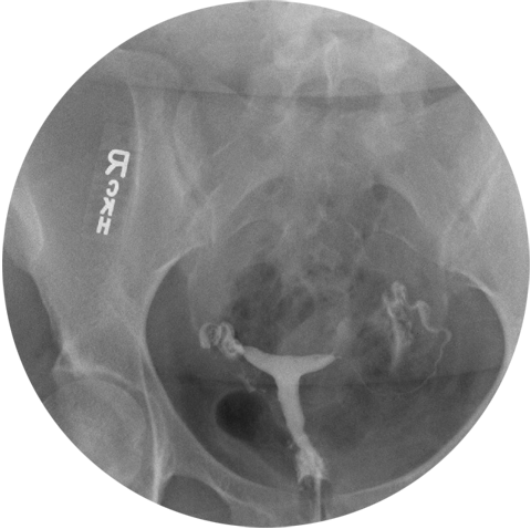 Kisaran Biaya Laparoskopi Tuba Falopi Tahun 2019  Klinik 